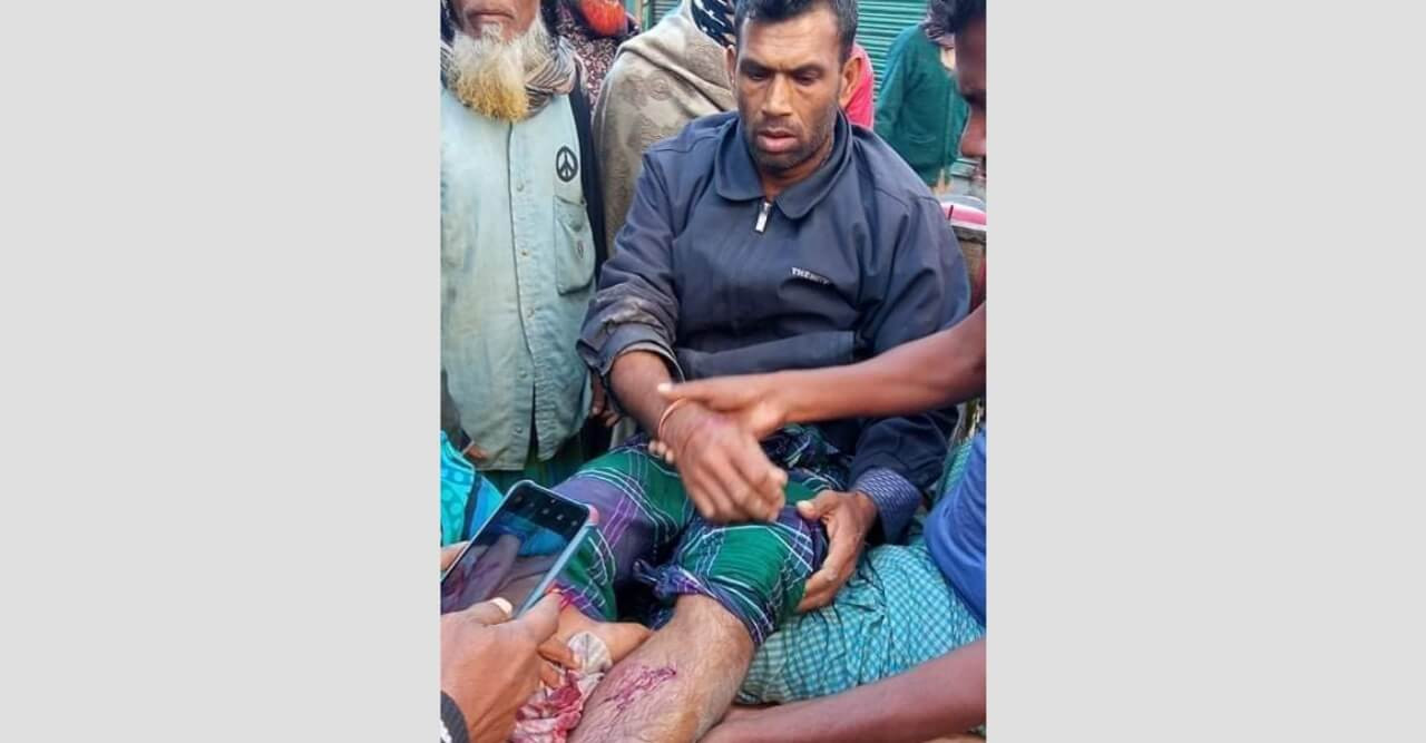 মাদক সেবন কারিদের বিরুদ্ধে প্রতিবাদ করায় এক শ্রমিক রক্তাক্ত