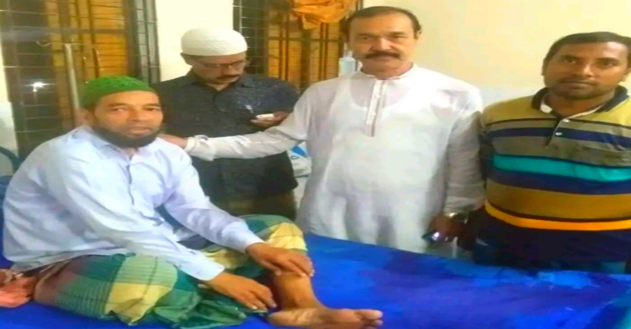 ছাত্রলীগের সাবেক সভাপতি হাফিজুরের অপারেশন সম্পন্ন