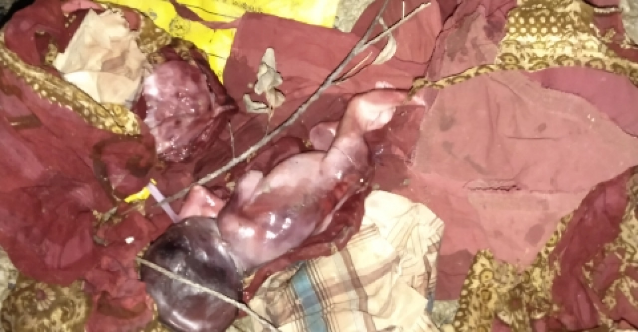 পরিত্যক্ত অবস্থায় নবজাতকের দেহ