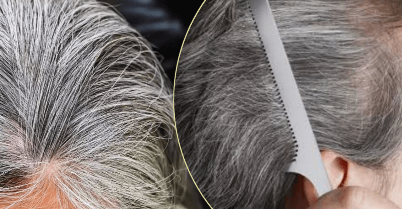 পাকা চুল তুলে ফেলার যত ক্ষতি