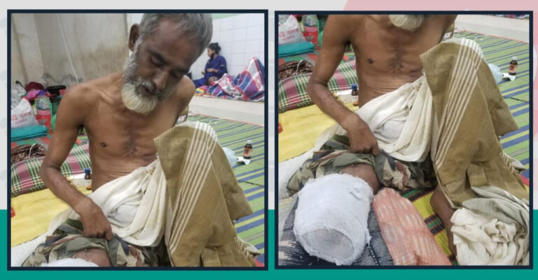 ট্রেনে পা কাটা ব্যক্তির চিকিৎসায় অর্থের প্রয়োজন