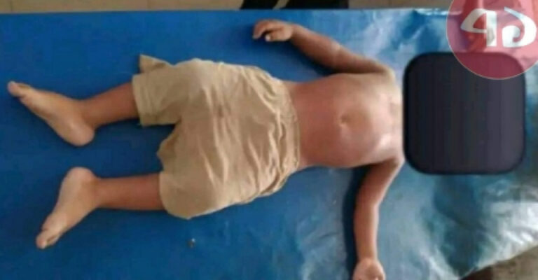 রাণীশংকৈলে পুকুরে ডুবে শিশুর মৃত্যু