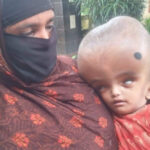 অস্বাভাবিক শিশু কন্যার ভার সইতে পারছেনা মা